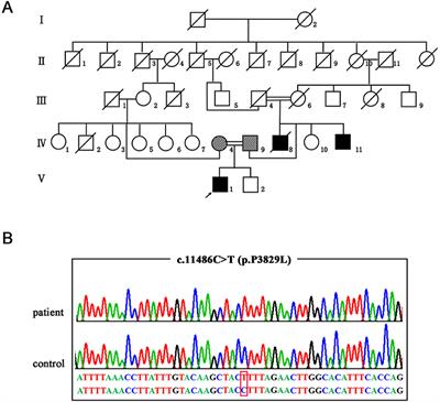 A Novel SACS Variant Identified in a Chinese Patient: Case Report and Review of the Literature